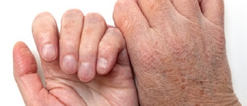 Rashes in the elderly: an overview - Pavilion Health Today Rashes in the elderly: an overview - Pavilion Health Today