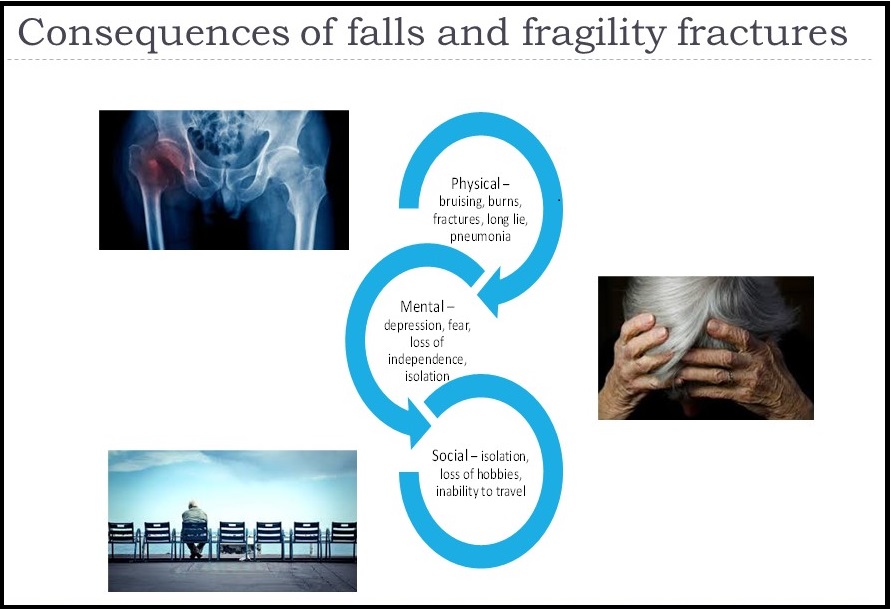 Fracture services slide 1